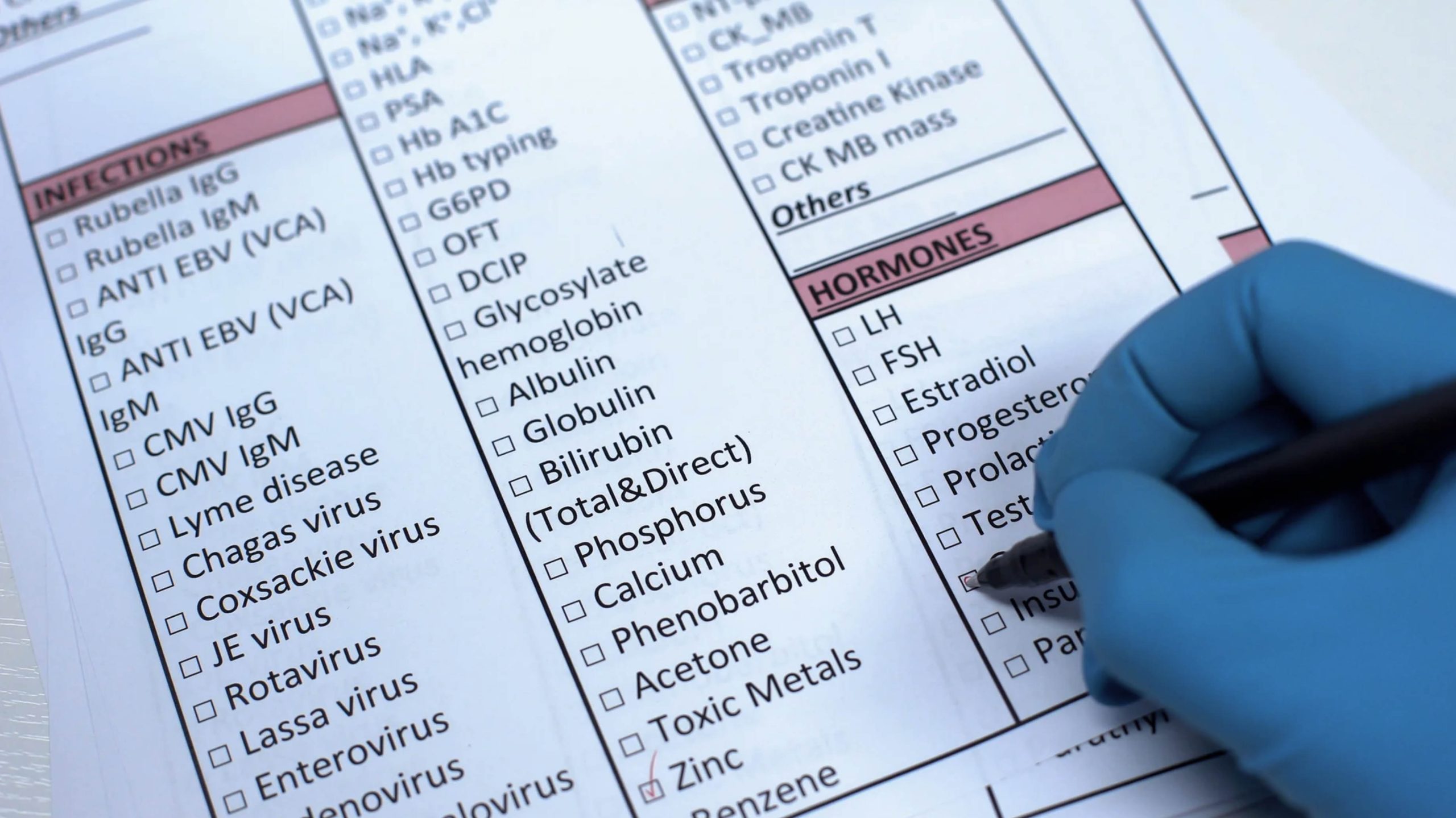 ACGrace - A person in blue gloves is writing on a sheet of paper.