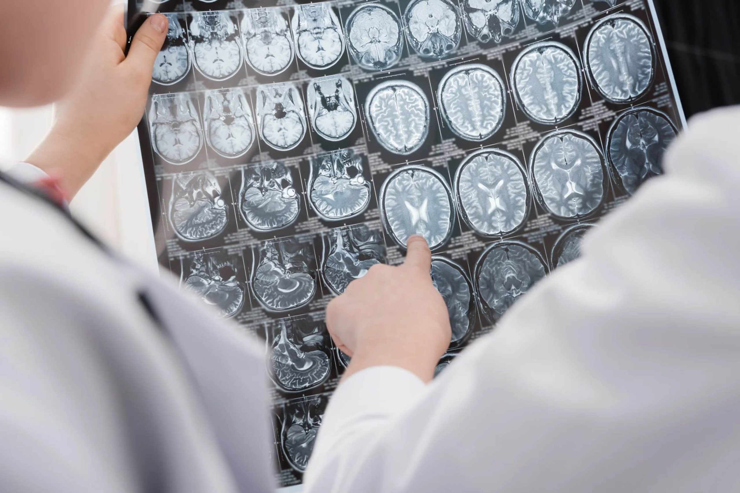 ACGrace - Two doctors looking at an mri.